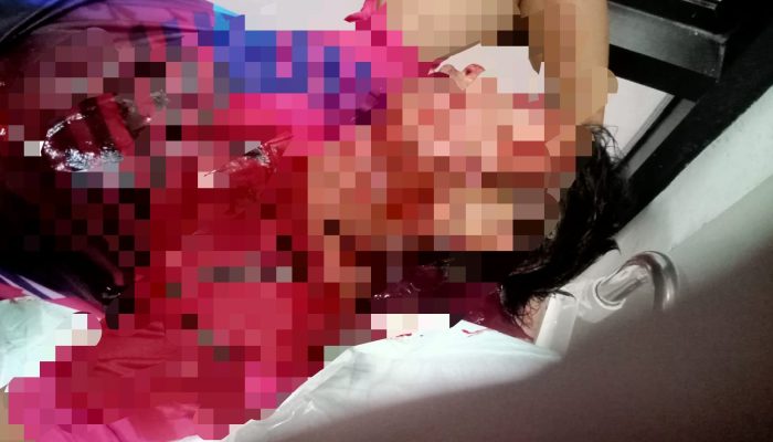 Kasus Pembacokan Petugas SPBU Camplong, Korban Alami Luka Parah